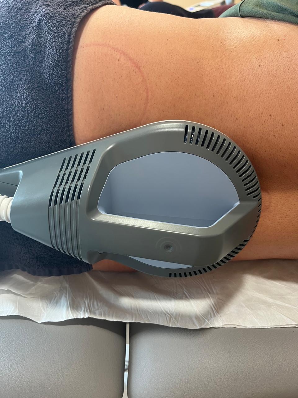 Εφαρμογή υπέρεπαγωγικού μαγνητικού διεγέρτη σε ασθενή με σπονδυλοαρθροπαθεια οσφυϊκής μοίρας Σπονδυλικής στήλης